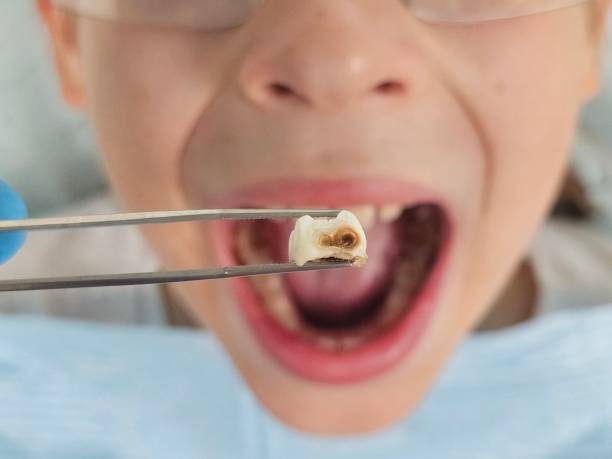 Best Emergency Pediatric Dental Care in Kensington, NY