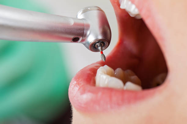 Professional Emergency Dental Service in NY